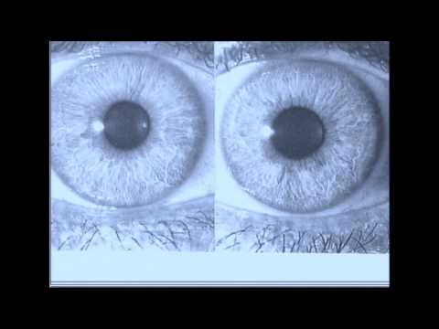 radio rai iridologia